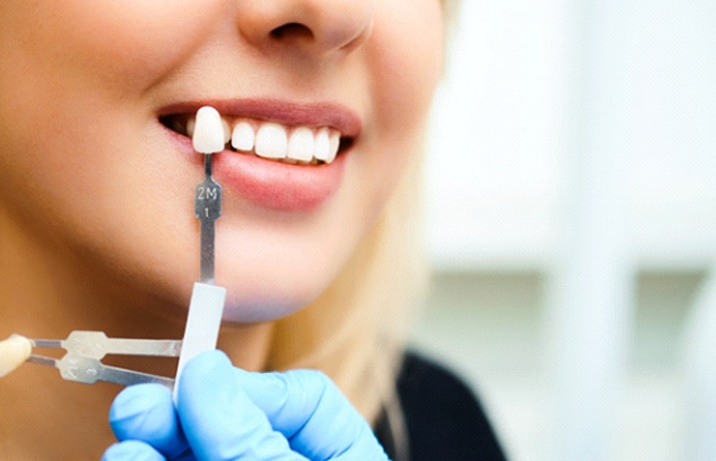 Gloved hand holding shade guide close to patient’s teeth