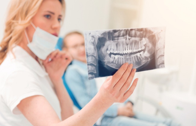 Dentist holding up X-ray to look at patient's molars