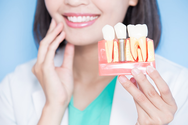 Dentist holding a model of dental implants